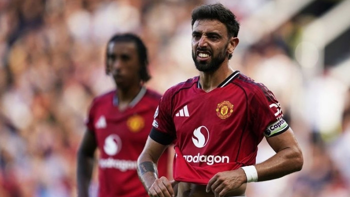 Bruno Fernandes Under Fire